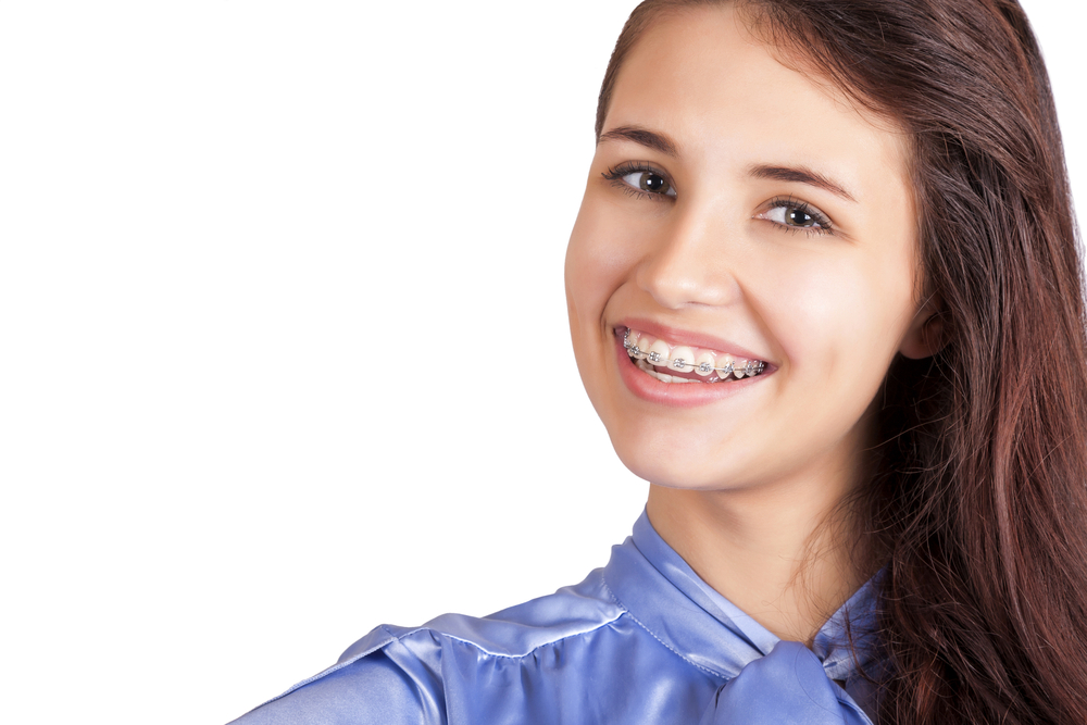 Braces Dentist Parramatta Braces Parramatta