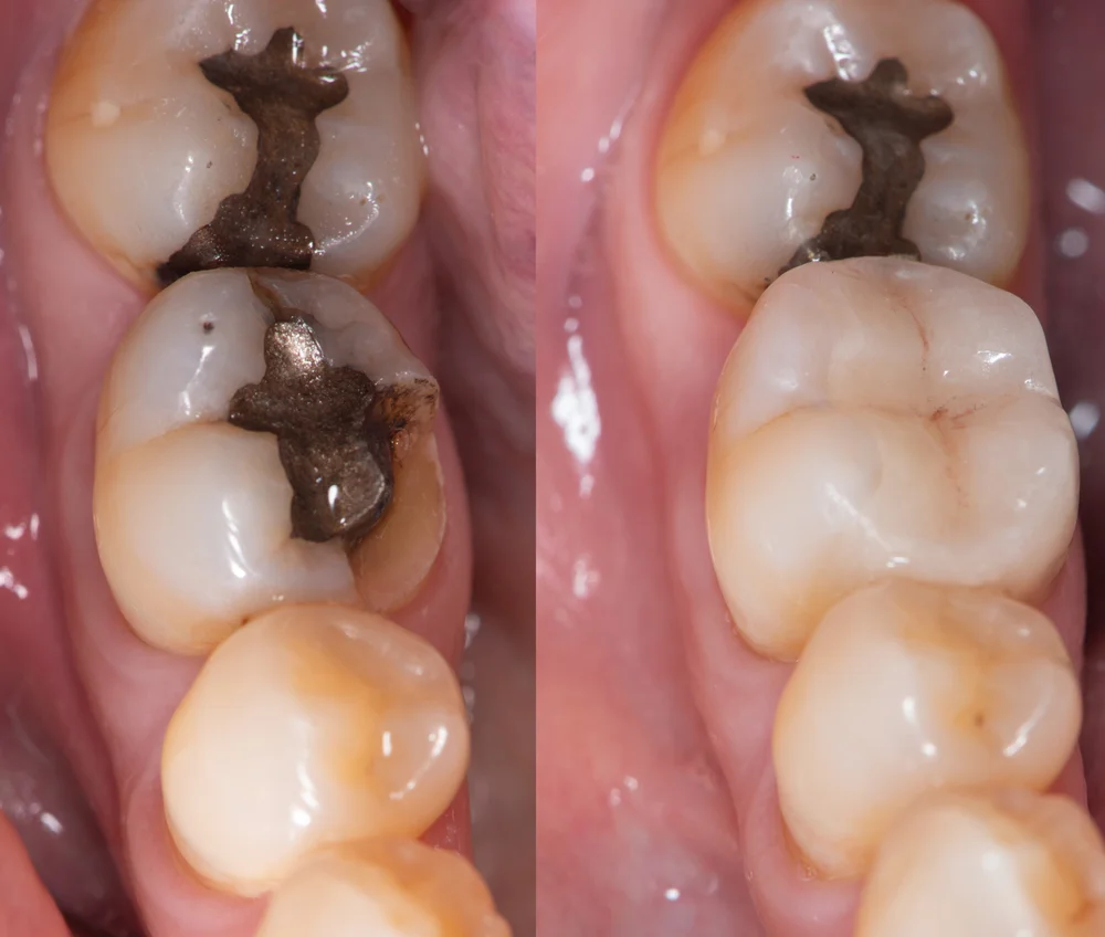 Dentist Greystanes